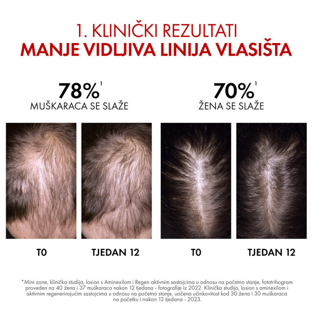 VICHY DERCOS AMINEXIL R.E.G.E.N. BOOSTER SERUM ZA OBNOVU KOSE 90ML