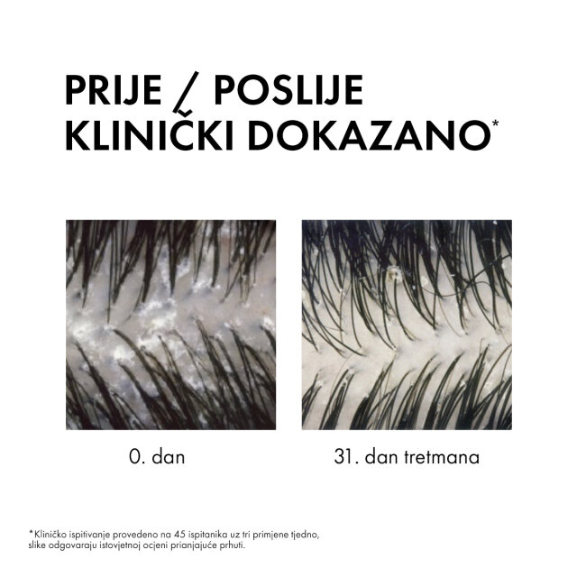 VICHY DERCOS ŠAMPON PROTIV PRHUTI DS  - 2 U 1: DERMOKOZMETIČKI ŠAMPON I REGENERATOR, 200 ML