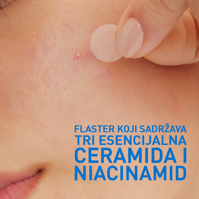 CERAVE BLEMISH CONTROL FLASTERI PROTIV NEPRAVILNOSTI, 22 KOMADA