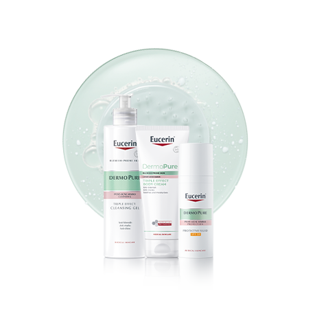 Masna koža sklona aknama